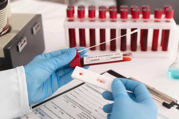 Какие анализы нужно сдать для обнаружения тромбов в крови