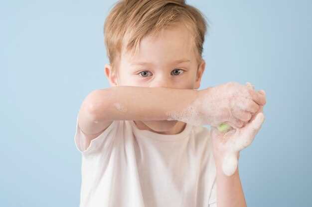Натуральные способы борьбы с атопическим дерматитом у малышей