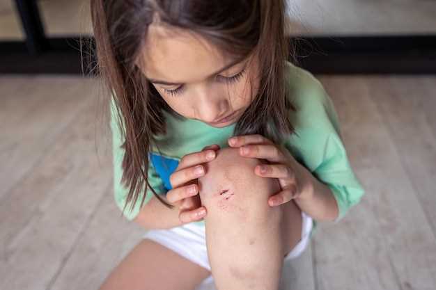 Эффективные методы лечения крапивницы у детей 10 лет