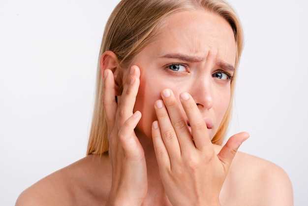 Эффективные способы лечения фурункула на носу