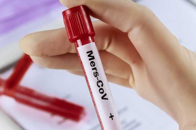 Анализ крови на кортизол: основные методики