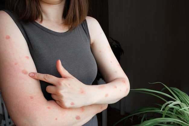 Основные признаки и симптомы: как отличить чесотку от аллергии