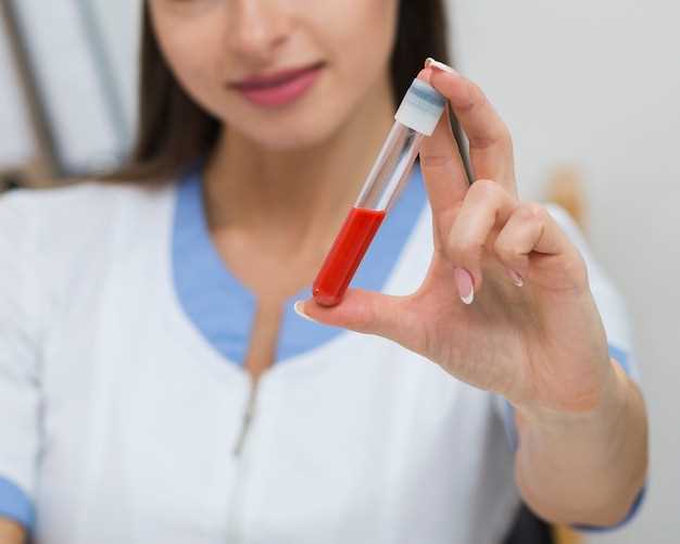 Секреты успешной подготовки к анализу крови на уровень витамина D