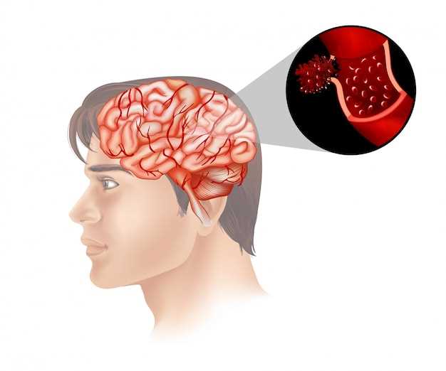 Методы улучшения кровообращения головного мозга