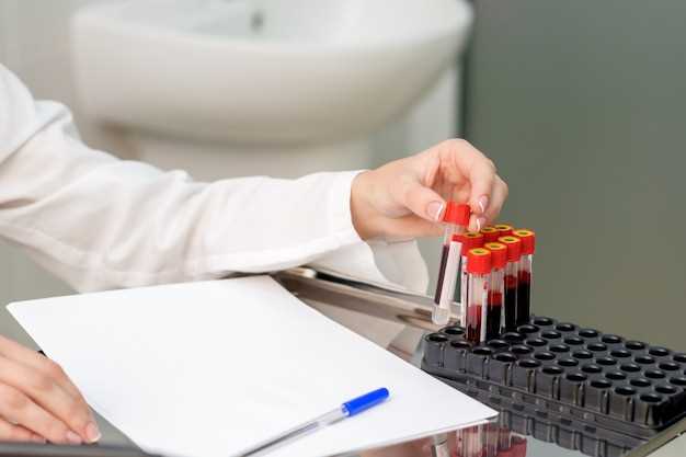 Как подготовиться к биохимическому анализу крови