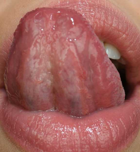 Эффективное лечение грибка на половых губах