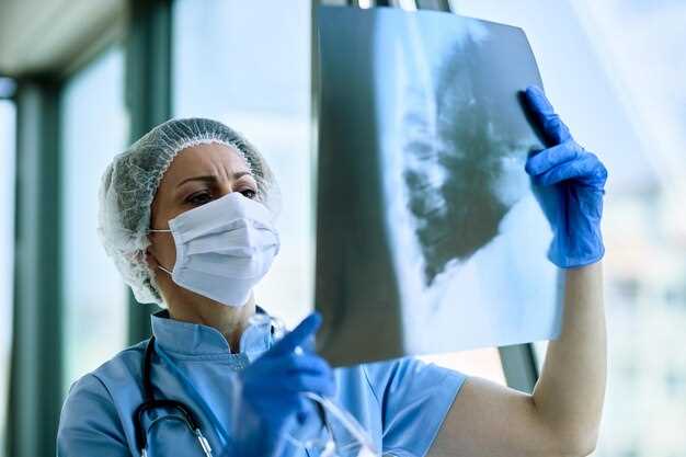 Диагностика туберкулеза легких с помощью рентгеноскопии
