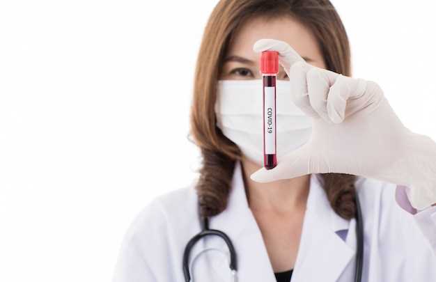 Сроки анализа крови: сколько времени нужно ожидать результаты
