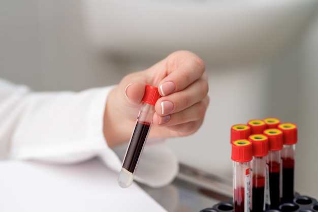 Методы анализа вязкости крови: основные исследования